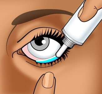 Illustration showing how to propery apply ointment after injection.